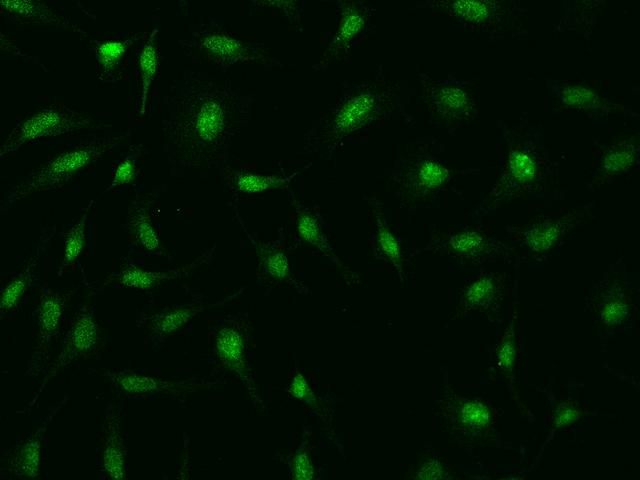 FBXO28 Antibody - Immunofluorescence staining of FBXO28 in HeLa cells. Cells were fixed with 4% PFA, permeabilzed with 0.1% Triton X-100 in PBS, blocked with 10% serum, and incubated with rabbit anti-Human FBXO28 polyclonal antibody (dilution ratio 1:1000) at 4°C overnight. Then cells were stained with the Alexa Fluor 488-conjugated Goat Anti-rabbit IgG secondary antibody (green). Positive staining was localized to Nucleus.