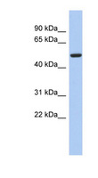 FBXO3 Antibody - FBXO3 antibody Western blot of Fetal Small Intestine lysate. This image was taken for the unconjugated form of this product. Other forms have not been tested.
