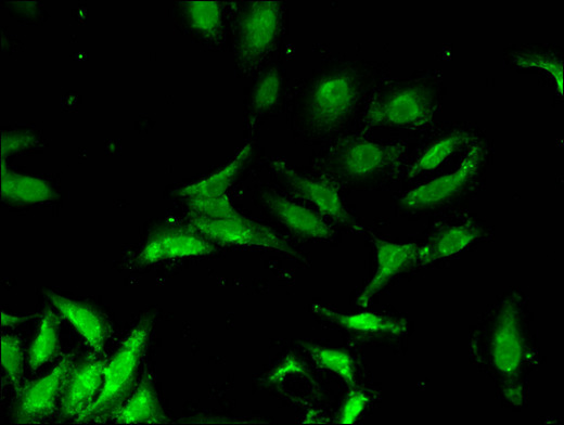 FBXO3 Antibody - Immunofluorescent analysis of Hela cells using FBXO3 Antibody at a dilution of 1:100 and Alexa Fluor 488-congugated AffiniPure Goat Anti-Rabbit IgG(H+L)