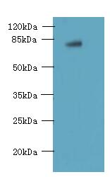 FBXO30 Antibody - Western blot. All lanes: FBXO30 antibody at 10 ug/ml+ Mouse brain tissue Goat polyclonal to rabbit at 1:10000 dilution. Predicted band size: 82 kDa. Observed band size: 82 kDa.