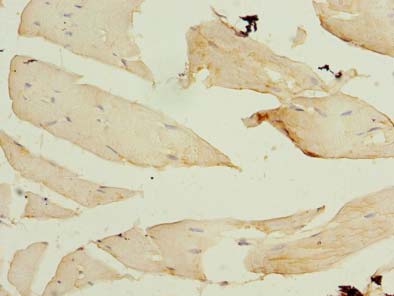 FBXO30 Antibody - Immunohistochemistry of paraffin-embedded human Skeletal muscle tissue using antibody at dilution of 1:100.