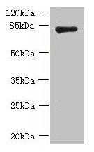 FBXO30 Antibody - Western blot All lanes: FBXO30 antibody at 10µg/ml + Mouse brain tissue Secondary Goat polyclonal to rabbit IgG at 1/10000 dilution Predicted band size: 83 kDa Observed band size: 83 kDa