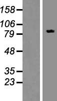 FBXO30 Protein - Western validation with an anti-DDK antibody * L: Control HEK293 lysate R: Over-expression lysate