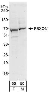 FBXO31 Antibody - Detection of Human and Mouse FBXO31 by Western Blot. Samples: Whole cell lysate (50 ug) from 293T (T) and mouse NIH3T3 (M) cells. Antibody: Affinity purified rabbit anti-FBXO31 antibody used for WB at 0.4 ug/ml. Detection: Chemiluminescence with an exposure time of 30 seconds.