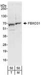 FBXO31 Antibody - Detection of Human and Mouse FBXO31 by Western Blot. Samples: Whole cell lysate (50 ug) from 293T (T) and mouse NIH3T3 (M) cells. Antibody: Affinity purified rabbit anti-FBXO31 antibody used for WB at 0.4 ug/ml. Detection: Chemiluminescence with an exposure time of 30 seconds.