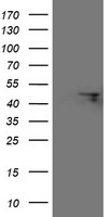 FBXO31 Antibody - HEK293T cells were transfected with the pCMV6-ENTRY control (Left lane) or pCMV6-ENTRY FBXO31 (Right lane) cDNA for 48 hrs and lysed. Equivalent amounts of cell lysates (5 ug per lane) were separated by SDS-PAGE and immunoblotted with anti-FBXO31.