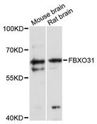 FBXO31 Antibody - Western blot analysis of extracts of various cell lines, using FBXO31 antibody at 1:3000 dilution. The secondary antibody used was an HRP Goat Anti-Rabbit IgG (H+L) at 1:10000 dilution. Lysates were loaded 25ug per lane and 3% nonfat dry milk in TBST was used for blocking. An ECL Kit was used for detection and the exposure time was 90s.
