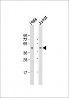 FBXO32 / Fbx32 Antibody - All lanes: Anti-FBXO32 Antibody (N-Term) at 1:2000 dilution. Lane 1: HeLa whole cell lysate. Lane 2: Jurkat whole cell lysate Lysates/proteins at 20 ug per lane. Secondary Goat Anti-Rabbit IgG, (H+L), Peroxidase conjugated at 1:10000 dilution. Predicted band size: 42 kDa. Blocking/Dilution buffer: 5% NFDM/TBST.