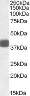 FBXO32 / Fbx32 Antibody - FBXO32 antibody (0.1 ug/ml) staining of Human Skeletal Muscle lysate (35 ug protein/ml in RIPA buffer). Primary incubation was 1 hour. Detected by chemiluminescence.