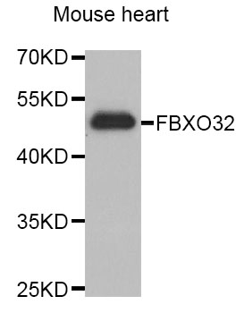 FBXO32 / Fbx32 Antibody - Western blot analysis of extracts of Mouse heart cell lines, using FBXO32 antibody.