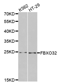 FBXO32 / Fbx32 Antibody - Western blot analysis of extracts of various cell lines, using FBXO32 antibody.