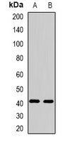FBXO32 / Fbx32 Antibody - Western blot analysis of FBXO32 expression in mouse heart (A); mouse skeletal muscle (B) whole cell lysates.