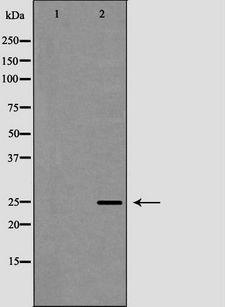 FBXO32 / Fbx32 Antibody - Western blot analysis of mouse heart lysate using FBXO32 antibody. The lane on the left is treated with the antigen-specific peptide.