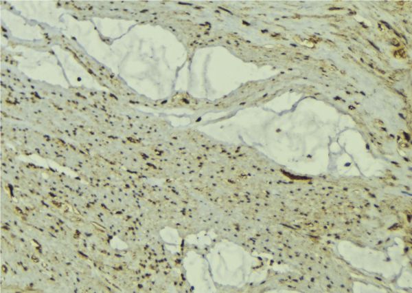 FBXO32 / Fbx32 Antibody - 1:100 staining mouse muscle tissue by IHC-P. The sample was formaldehyde fixed and a heat mediated antigen retrieval step in citrate buffer was performed. The sample was then blocked and incubated with the antibody for 1.5 hours at 22°C. An HRP conjugated goat anti-rabbit antibody was used as the secondary.