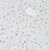 FBXO32 / Fbx32 Antibody - Immunohistochemistry of paraffin-embedded Rat liver using FBXO32 Polyclonal Antibody at dilution of 1:100 (40x lens).