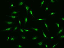 FBXO34 Antibody - Immunofluorescence staining of FBXO34 in HeLa cells. Cells were fixed with 4% PFA, permeabilzed with 0.1% Triton X-100 in PBS, blocked with 10% serum, and incubated with rabbit anti-Human FBXO34 polyclonal antibody (dilution ratio 1:200) at 4°C overnight. Then cells were stained with the Alexa Fluor 488-conjugated Goat Anti-rabbit IgG secondary antibody (green). Positive staining was localized to Nucleus.
