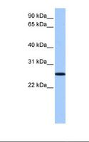 FBXO36 / F-Box Protein 36 Antibody - Fetal liver lysate. Antibody concentration: 1.0 ug/ml. Gel concentration: 12%.  This image was taken for the unconjugated form of this product. Other forms have not been tested.