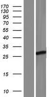 FBXO36 / F-Box Protein 36 Protein - Western validation with an anti-DDK antibody * L: Control HEK293 lysate R: Over-expression lysate