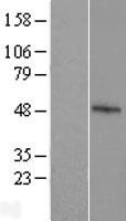 FBXO39 Protein - Western validation with an anti-DDK antibody * L: Control HEK293 lysate R: Over-expression lysate