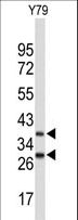FBXO4 / FBX4 Antibody - Western blot of FBXO4 Antibody in Y79 cell line lysates (35 ug/lane). FBXO4 (arrow) was detected using the purified antibody.