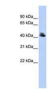 FBXO4 / FBX4 Antibody - FBXO4 antibody Western blot of 293T cell lysate. This image was taken for the unconjugated form of this product. Other forms have not been tested.