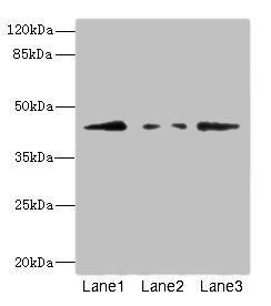 FBXO4 / FBX4 Antibody - Western blot All Lanes: FBXO4 antibody at 3.1ug/ml Lane 1: 293T whole cell lysate Lane 2: HepG-2 whole cell lysate Lane 3: HL60 whole cell lysate Secondary Goat polyclonal to rabbit IgG at 1/10000 dilution Predicted band size: 45,36 kDa Observed band size: 44 kDa