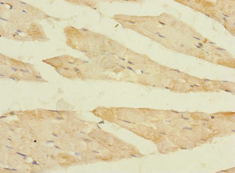 FBXO40 Antibody - Immunohistochemistry of paraffin-embedded human skeletal muscle tissue using FBXO40 Antibody at dilution of 1:100
