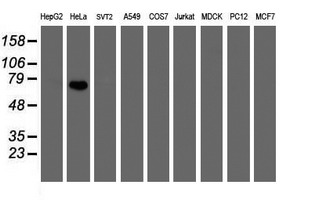 FBXO42 / JFK Antibody - Western blot of extracts (35 ug) from 9 different cell lines by using anti-FBXO42 monoclonal antibody (HepG2: human; HeLa: human; SVT2: mouse; A549: human; COS7: monkey; Jurkat: human; MDCK: canine; PC12: rat; MCF7: human).