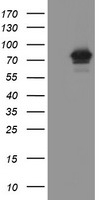 FBXO42 / JFK Antibody - HEK293T cells were transfected with the pCMV6-ENTRY control (Left lane) or pCMV6-ENTRY FBXO42 (Right lane) cDNA for 48 hrs and lysed. Equivalent amounts of cell lysates (5 ug per lane) were separated by SDS-PAGE and immunoblotted with anti-FBXO42.
