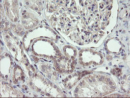 FBXO42 / JFK Antibody - IHC of paraffin-embedded Human Kidney tissue using anti-FBXO42 mouse monoclonal antibody.