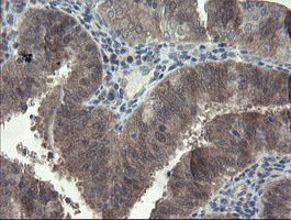 FBXO42 / JFK Antibody - IHC of paraffin-embedded Human pancreas tissue using anti-FBXO42 mouse monoclonal antibody.