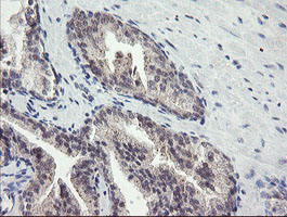 FBXO42 / JFK Antibody - IHC of paraffin-embedded Human prostate tissue using anti-FBXO42 mouse monoclonal antibody.