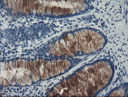 FBXO42 / JFK Antibody - IHC of paraffin-embedded Human colon tissue using anti-FBXO42 mouse monoclonal antibody.