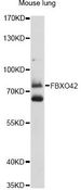 FBXO42 / JFK Antibody - Western blot analysis of extracts of mouse lung, using FBXO42 antibody at 1:1000 dilution. The secondary antibody used was an HRP Goat Anti-Rabbit IgG (H+L) at 1:10000 dilution. Lysates were loaded 25ug per lane and 3% nonfat dry milk in TBST was used for blocking. An ECL Kit was used for detection and the exposure time was 90s.