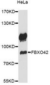 FBXO42 / JFK Antibody - Western blot analysis of extracts of HeLa cells, using FBXO42 antibody at 1:1000 dilution. The secondary antibody used was an HRP Goat Anti-Rabbit IgG (H+L) at 1:10000 dilution. Lysates were loaded 25ug per lane and 3% nonfat dry milk in TBST was used for blocking. An ECL Kit was used for detection and the exposure time was 60s.