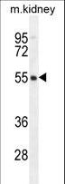 FBXO47 Antibody - FBXO47 Antibody western blot of mouse kidney tissue lysates (35 ug/lane). The FBXO47 antibody detected the FBXO47 protein (arrow).