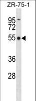 FBXO5 / EMI1 Antibody - FBXO5 Antibody western blot of ZR-75-1 cell line lysates (35 ug/lane). The FBXO5 antibody detected the FBXO5 protein (arrow).