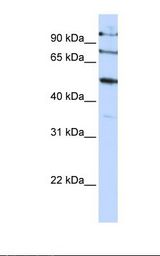 FBXO5 / EMI1 Antibody - HepG2 cell lysate. Antibody concentration: 1.0 ug/ml. Gel concentration: 12%.  This image was taken for the unconjugated form of this product. Other forms have not been tested.