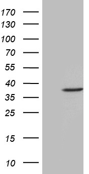 FBXO6 Antibody - HEK293T cells were transfected with the pCMV6-ENTRY control. (Left lane) or pCMV6-ENTRY FBXO6. (Right lane) cDNA for 48 hrs and lysed. Equivalent amounts of cell lysates. (5 ug per lane) were separated by SDS-PAGE and immunoblotted with anti-FBXO6. (1:2000)