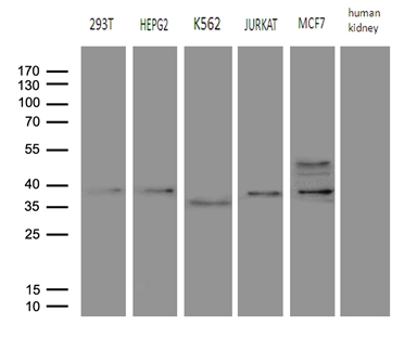 FBXO6 Antibody - Western blot analysis of extracts. (35ug) from 5 different cell lines and human kidney tissue lysate by using anti-FBXO6 monoclonal antibody. (1:500)