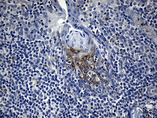 FBXO6 Antibody - Immunohistochemical staining of paraffin-embedded Human tonsil within the normal limits using anti-FBXO6 mouse monoclonal antibody. (Heat-induced epitope retrieval by 1mM EDTA in 10mM Tris buffer. (pH8.5) at 120°C for 3 min. (1:150)