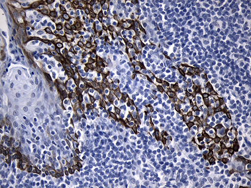 FBXO6 Antibody - Immunohistochemical staining of paraffin-embedded Human tonsil within the normal limits using anti-FBXO6 mouse monoclonal antibody. (Heat-induced epitope retrieval by 1mM EDTA in 10mM Tris buffer. (pH8.5) at 120°C for 3 min. (1:150)