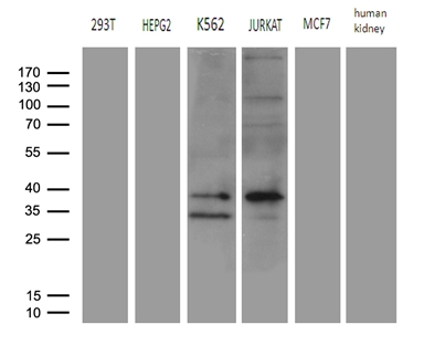 FBXO6 Antibody - Western blot analysis of extracts. (35ug) from 5 different cell lines and human kidney tissue lysate by using anti-FBXO6 monoclonal antibody. (1:500)