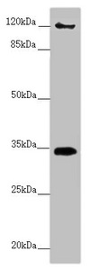 FBXO6 Antibody - Western blot All Lanes:FBXO6 antibody at 3.87 ug/ml+ A431 whole cell lysate Secondary Goat polyclonal to rabbit IgG at 1/10000 dilution Predicted band size: 34 kDa Observed band size: 34120 kDa