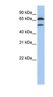 FBXO7 Antibody - FBXO7 antibody Western blot of MCF7 cell lysate. This image was taken for the unconjugated form of this product. Other forms have not been tested.