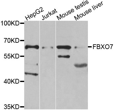 FBXO7 Antibody - Western blot analysis of extracts of various cell lines.