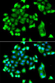 FBXO7 Antibody - Immunofluorescence analysis of A549 cells.