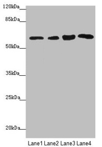 FBXO7 Antibody - Western blot All lanes: FBXO7 antibody at 3.97µg/ml Lane 1: Mouse gonadal tissue Lane 2: Jurkat whole cell lysate Lane 3: 293T whole cell lysate Lane 4: PC-3 whole cell lysate Secondary Goat polyclonal to rabbit IgG at 1/10000 dilution Predicted band size: 59, 50, 46 kDa Observed band size: 59 kDa