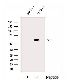 FBXO7 Antibody - Western blot analysis of extracts of MCF-7 cells using FBXO7 antibody. The lane on the left was treated with blocking peptide.