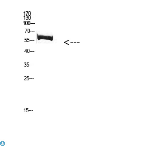 FBXO7 Antibody - Western Blot (WB) analysis of Mouse Kidney cells using Antibody diluted at 1:1000.